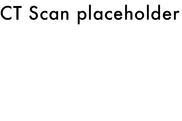 CT Scan Lede Placeholder